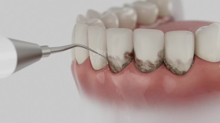 Trusted Tooth Extraction service in Kodiak Station, AK - Dentist Open Now